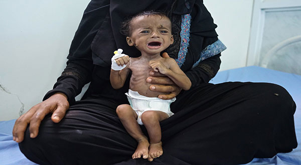 Yemen